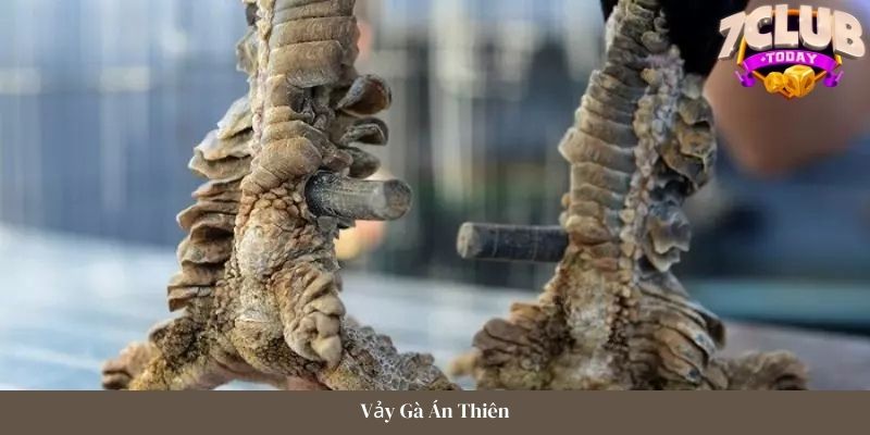 Hiểu đúng về vảy gà án thiên